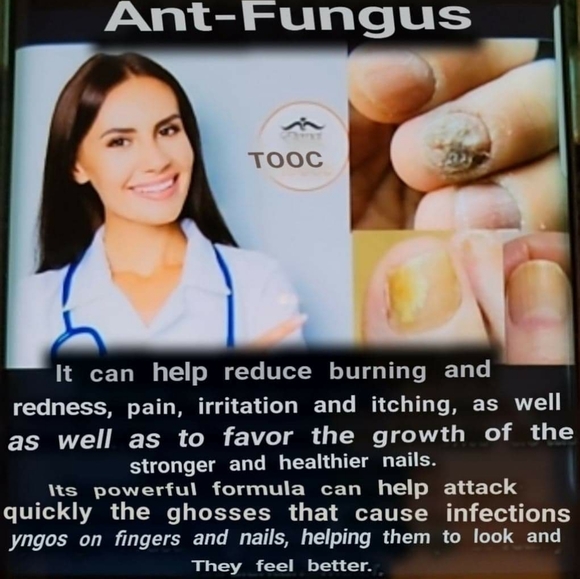 Fungi Freh/ Anti-Fungus EternalSpiritBeauty - Picture 2 of 12